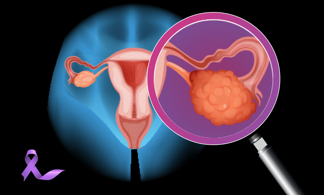 Gynecologic-cancer-banner